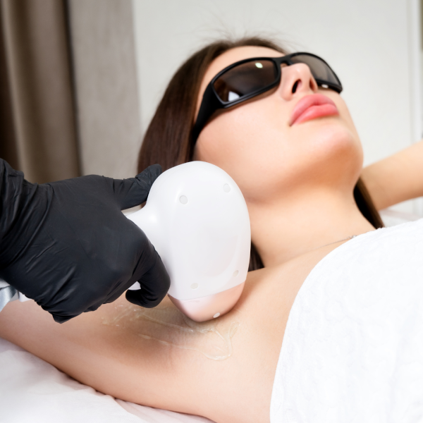 LASER HAIR REMOVAL